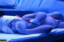 دستگاه زردی نوزاد(فتوتراپی)