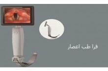 لارنگ اسکوپ ویدئویی